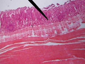 Human Tonsil W/Lymph Nodules