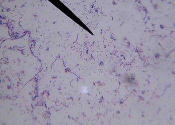 Bacteria from Human Intestine
